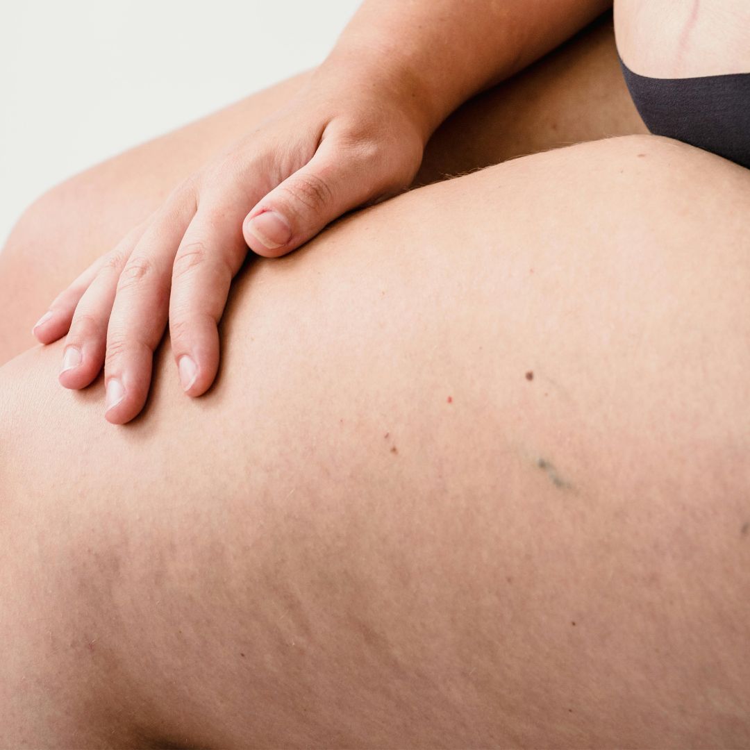 Graisse viscérale : comprendre, prévenir et agir